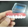 Perfect Smile Veneers